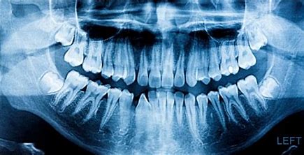General Dentistry